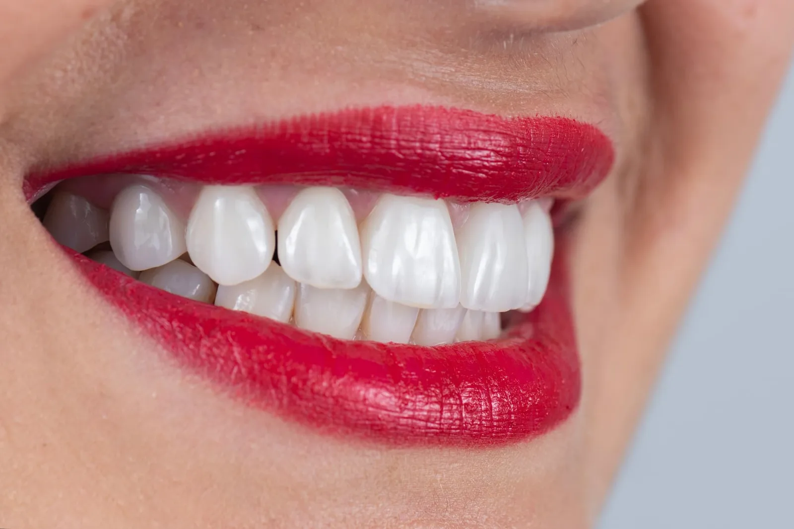 All-on-4 vs Traditional Dental Implants: What’s the Difference? — Samuel F. Jirik DDS, Cabot, Arkansas