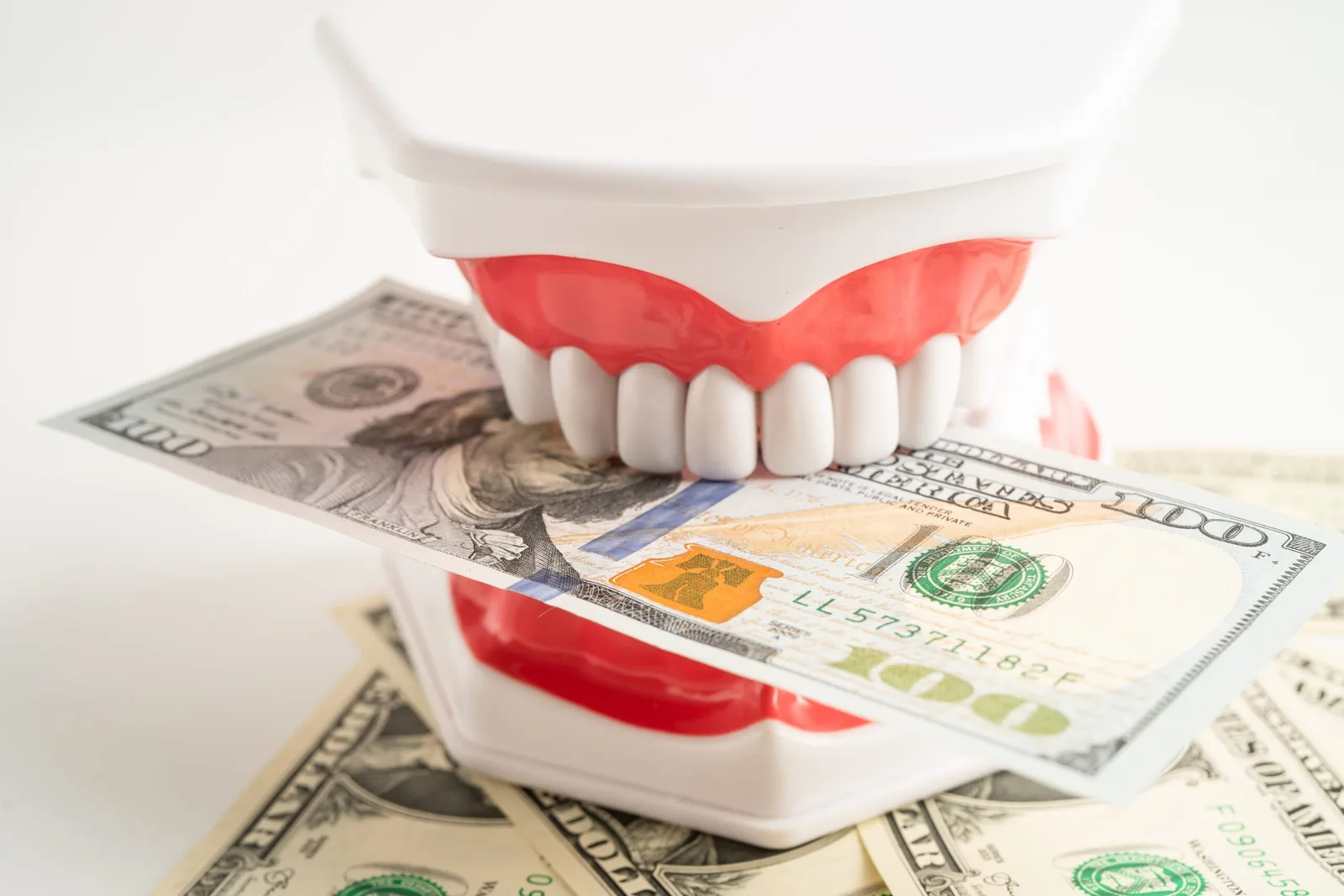 What Affects Dental Implant Cost: A Transparent Breakdown — Samuel F. Jirik DDS, Cabot, Arkansas